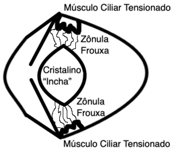 Músculo Ciliar Tensionado na Fadiga Ocular