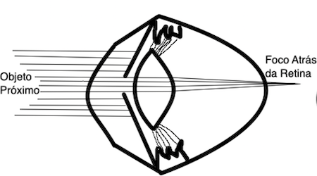 Objeto Próximo Desfocado na Fadiga Ocular
