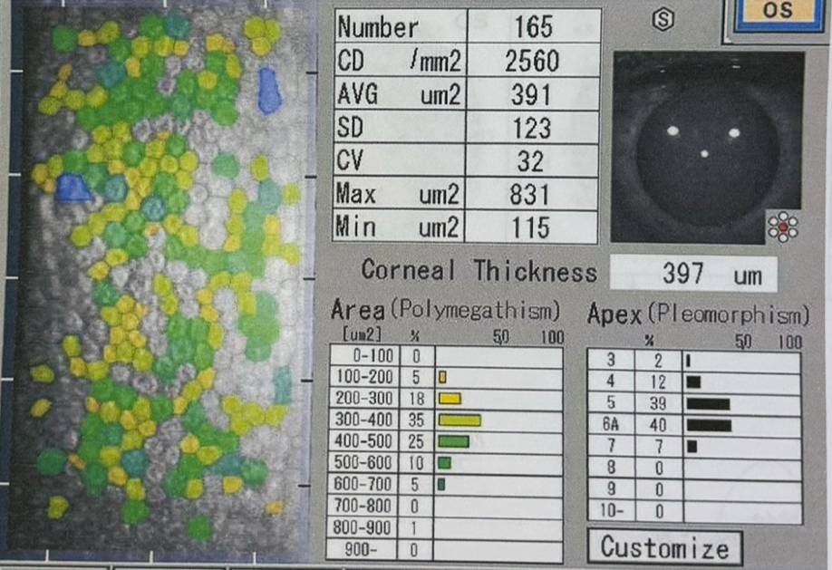 exame microscopia especular